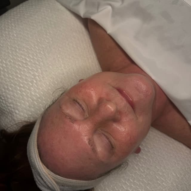 Anti-Aging BUNDLE at Luxe Haven Skin&Esthetics in Alliance, OH